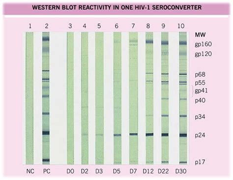 hiv western blot interpretation